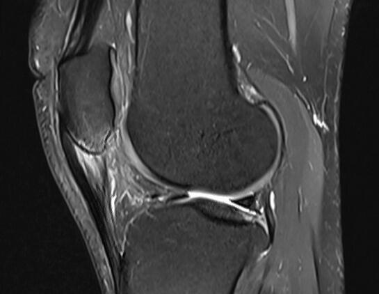 Private MRI Knee scan in Leeds, Harrogate